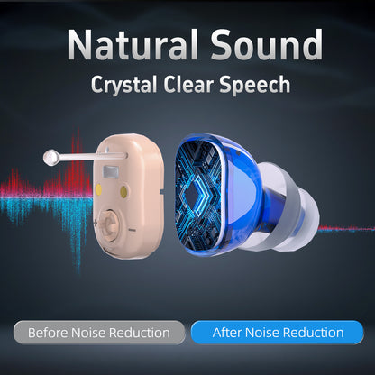 Delmicure VHP-1631L Hearing Aids, Rechargeable Hearing Amplifiers with Portable Charging Case, Binaural (Beige)